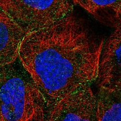 MTHFSD Antibody, Novus Biologicals 0.1mL; Unlabeled:Antibodies, Polyclonal
